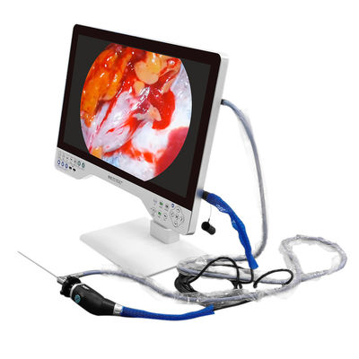 kaufen Elektrische 4K-Monitor-Medizinische Endoskopie-Kamera mit eingebauter Lichtquelle und USB-Aufzeichnung on-line-Fertigung