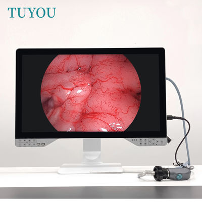 kaufen TUYOU 27-Zoll 1080P Full HD All-in-One Medizinische Endoskopkamera für Arthroskop on-line-Fertigung
