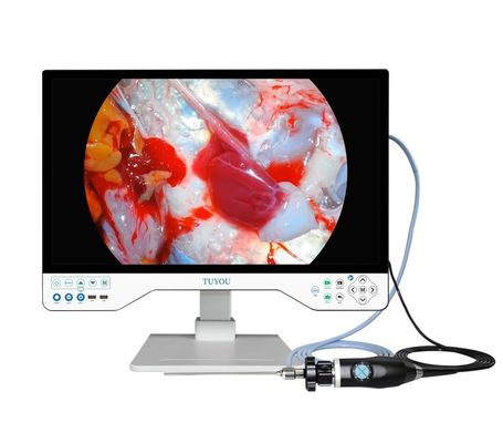 kaufen All-in-One-KOR-Kamerasystem mit tragbarer HD-Endoskopkamera und Lichtquelle on-line-Fertigung