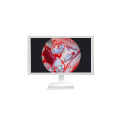 kaufen FHD-Medizintechnik 22 24 27 Zoll Endoskop-Kamera-Monitor Anzeige Full HD-Medizinischer Monitor on-line-Fertigung