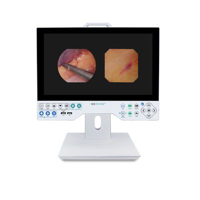 kaufen TUYOU Full HD 1080P 15,6 Zoll All-in-One Medizinisches Endoskopie-Kamerasystem für HNO-Sinus-Urologie on-line-Fertigung