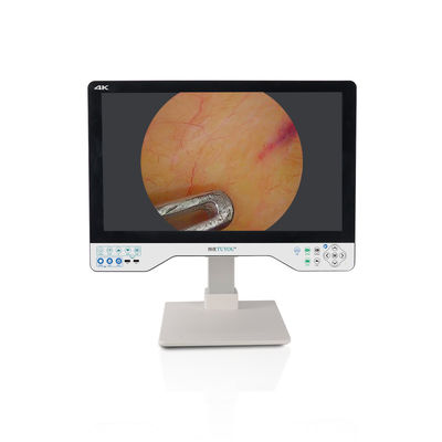 kaufen 24 Zoll Laparoskopischer Monitor 4K UHD Endoskop Kamerasystem Chirurgische LED mit Lichtquelle on-line-Fertigung