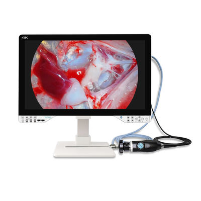kaufen AC110V-250V Medizinische 4K ENT Endoskopie Kamera mit Lichtquelle und Monitor on-line-Fertigung