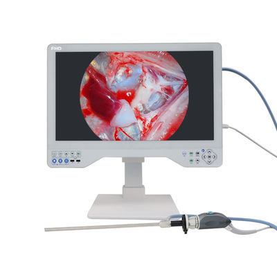 kaufen All-in-One-Medizinisches Endoskop-Kamerasystem mit Full-HD-Bildgebung für HNO und Laparoskopie on-line-Fertigung