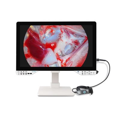 kaufen 27 Zoll FHD-Endoskop-Kamerasystem mit 100 W LED-Licht für HNO-Chirurgie on-line-Fertigung