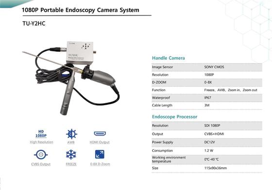 kaufen TUYOU TU-Y2HC FHD Portable Medical Endoskopkamera mit HDMI/CVBS FÜR HNO, 0-8X D-Zoom on-line-Fertigung