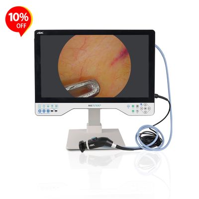kaufen All-in-one Camera System With 24 Inches Monitor For Laparoscopy ENT Surgery Manufacturer  on-line-Fertigung