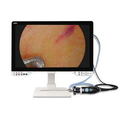 27 Zoll Endoskop 4K für laparoskopische Chirurgie mit Lichtquelle und Monitor