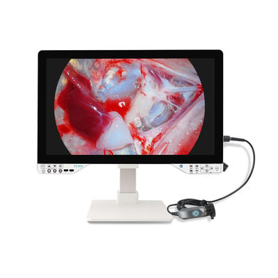 Innovatives Full-HD-Endoskop-Kamera-Kit mit Lichtquelle und 27' Monitor für Gynäkologie