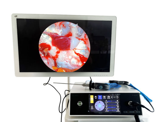 Full HD 1080P HNO Portable Endoskopie Kamera mit Touchscreen und LED-Lichtquelle