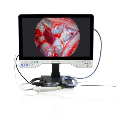 15-Zoll-Monitor-Modus-Auswahl TUYOU All-in-One-Medizinische Endoskopkamera mit Lichtquelle für Urologie und Gynäkologie