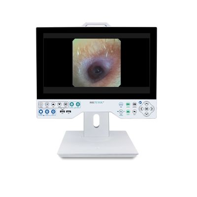 All-in-one starre und flexible Endoskopie-Kamera TU-15LSD1E HDMI/SDI/CVBS/VGA/DVI-Ausgabeoberfläche und eingebaute Lichtquelle