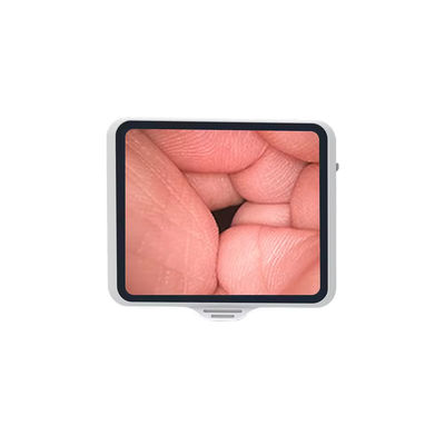 TUYOU 3,5 Zoll wiederverwendbares flexibles Handendoskop Medizinisches System für HNO-Pflege
