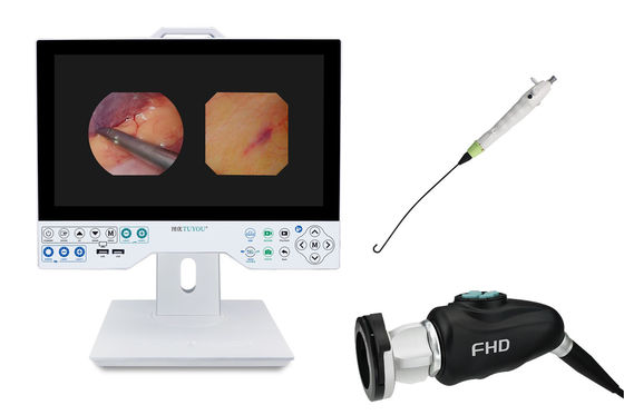 TUYOU Gehirnchirurgie-Tool All-in-One starres und flexibles Endoskopie-Kamerasystem für Uterusuntersuchungen