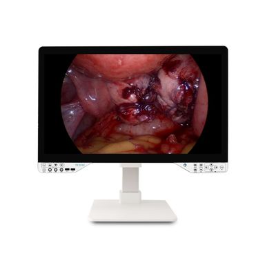 27 Zoll FHD 1080P Endoskopische Kamerasystem Nur starres Endoskop mit Monitor und 100W Wirkleistung
