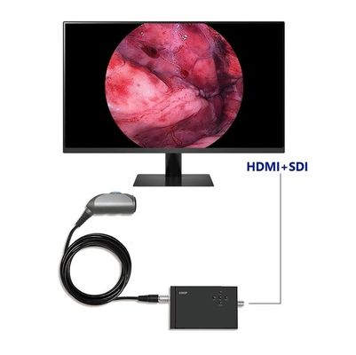 TUYOU Portable Endoskopie Videokamera Full HD 1920x1080 Auflösung 120 Grad Sichtfeld für Urologie Wirbelsäule und HNO Chirurgie