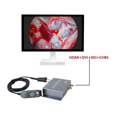 Herstellung TUYOU Integrierte tragbare 1080P-Medizinische Bildgebung Endoskopie-Kamera für Ent Nasen- und Tierchirurgie
