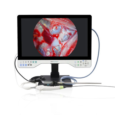 4K All-in-One-Endoskop-Kamerasystem Eingebettetes LED-Licht und flexibler Bereich für die Laparoskopie