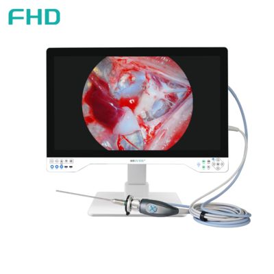 TUYOU All-in-One FHD Endoskopie-Kamerasystem mit 32 Zoll Chirurgischem Monitor für HNO- und Urologieverfahren