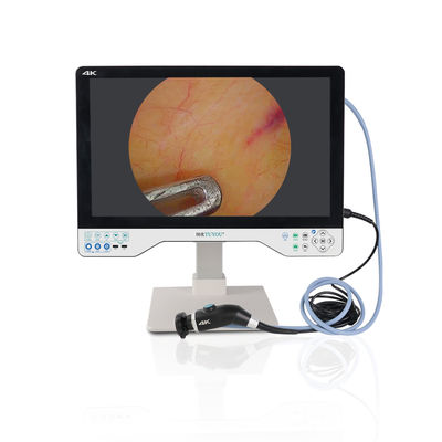 Hersteller Direkt 24 Zoll 1080P All-in-One-Kamerasystem für Laparoskopie Chirurgie HNO-Prüfung