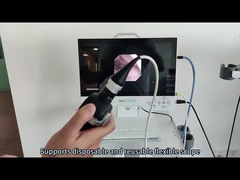 TU-15LSD1C All-in-One-Endoskopie-Kamerasystem mit Full-HD-Bildgebung für HNO und Laparoskopie
