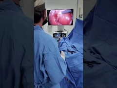 TU-LSD90TB 2-in-1-Kamerasystem mit kalter Lichtquelle für Laparoskopie und HNO