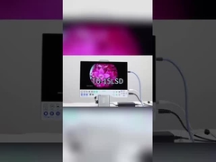 TUYOU Full HD 1080P 15,6 Zoll All-in-One Medizinisches Endoskopie-Kamerasystem für HNO-Sinus-Urologie